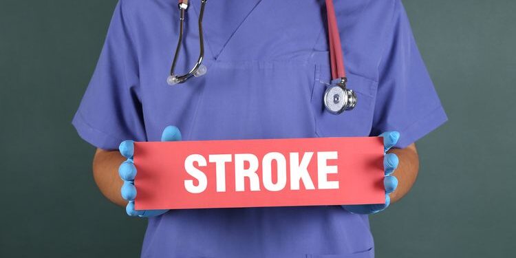 Stroke (ilustrasi)