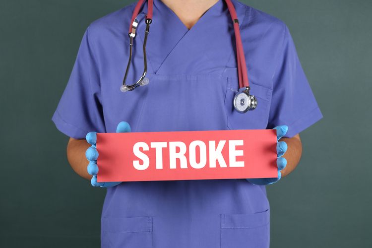 Stroke (ilustrasi)