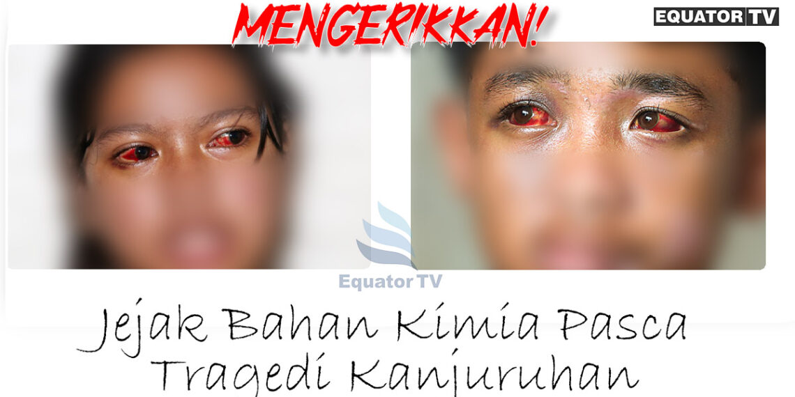 Mengerikkan! Jejak Bahan Kimia Pasca Tragedi Kanjuruhan